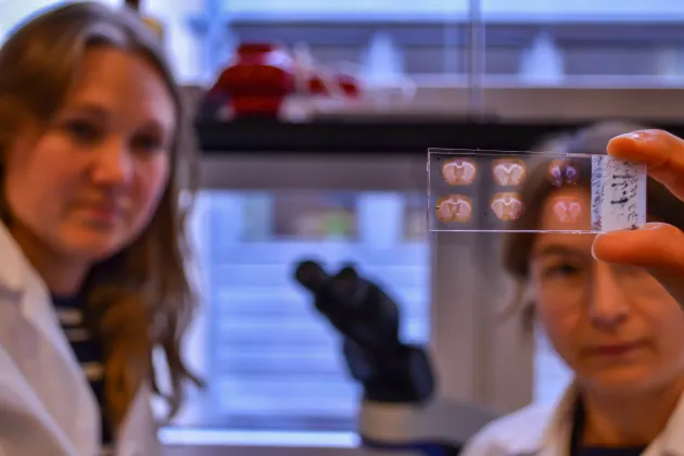 he researchers stained brain sections to identify how different Parkinson’s treatments activate distinct brain circuits. Photo: Emma Nyberg.